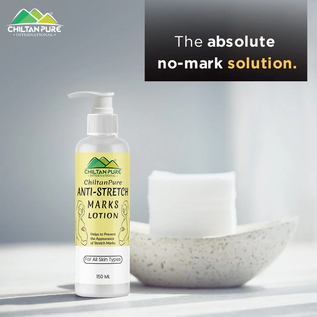 Anti-Stretch Marks Lotion – Formulated To Repair, Diminish & Prevent Stretch Marks With Intense Hydration & Smoothing, Good For Pregnancy Skincare 150ml - Image 2