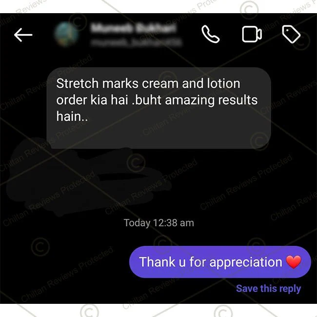 Anti-Stretch Marks Lotion – Formulated To Repair, Diminish & Prevent Stretch Marks With Intense Hydration & Smoothing, Good For Pregnancy Skincare 150ml - Image 4