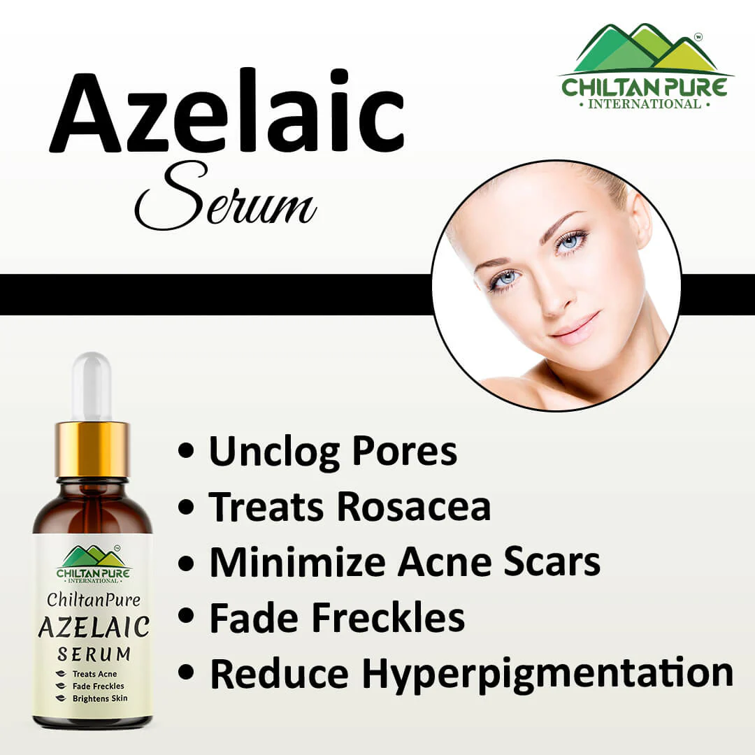 Azelaic Acid Serum / Azelaic Serum  - Brightens Skin, Treats Acne, Unclogs Pores, Fade Freckles & Lighten Acne Scars - Image 2