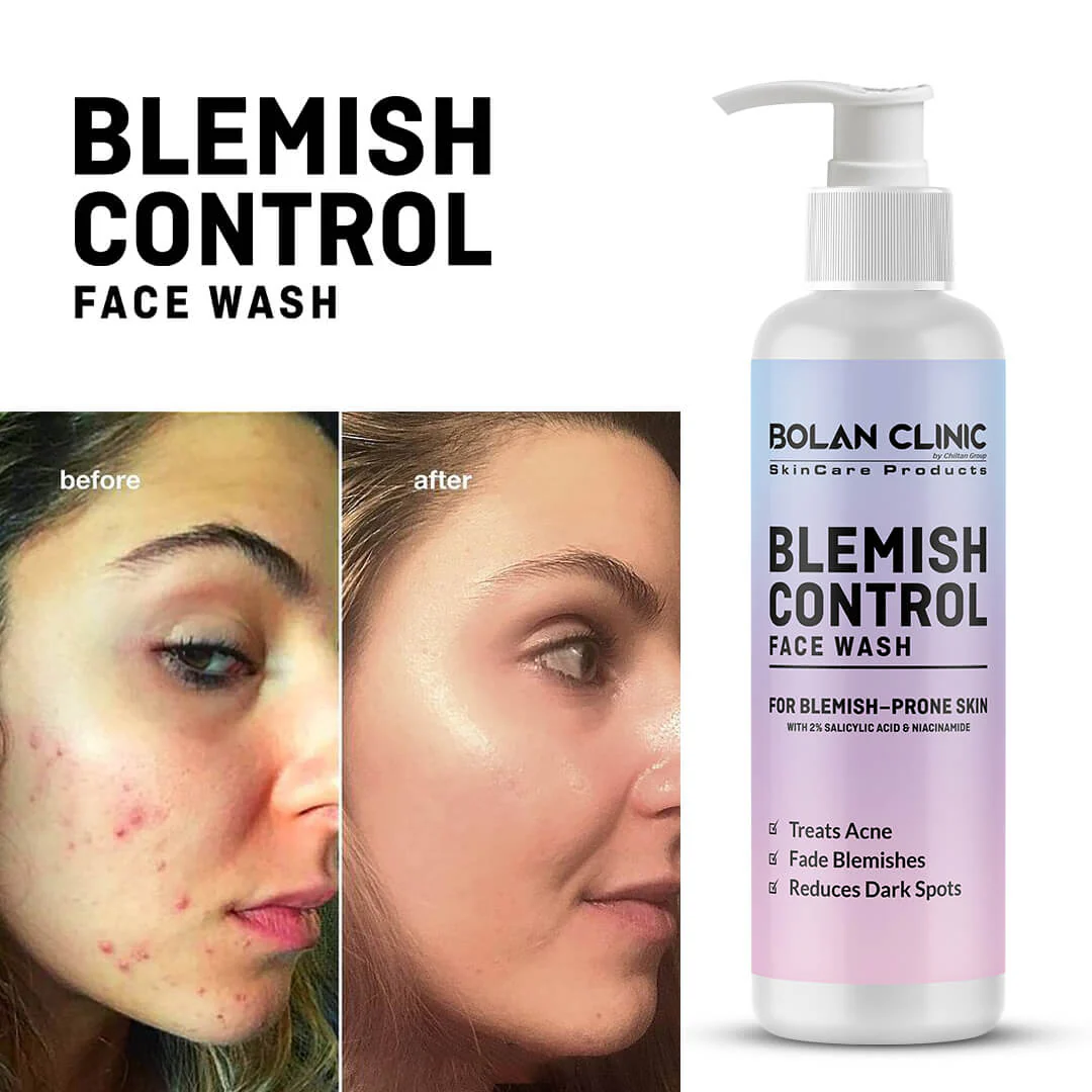 Blemish Control Face Wash - Made with 2% Salicylic Acid & Niacinamide, Treats Acne, Fades Blemishes & Reduces Dark Spots