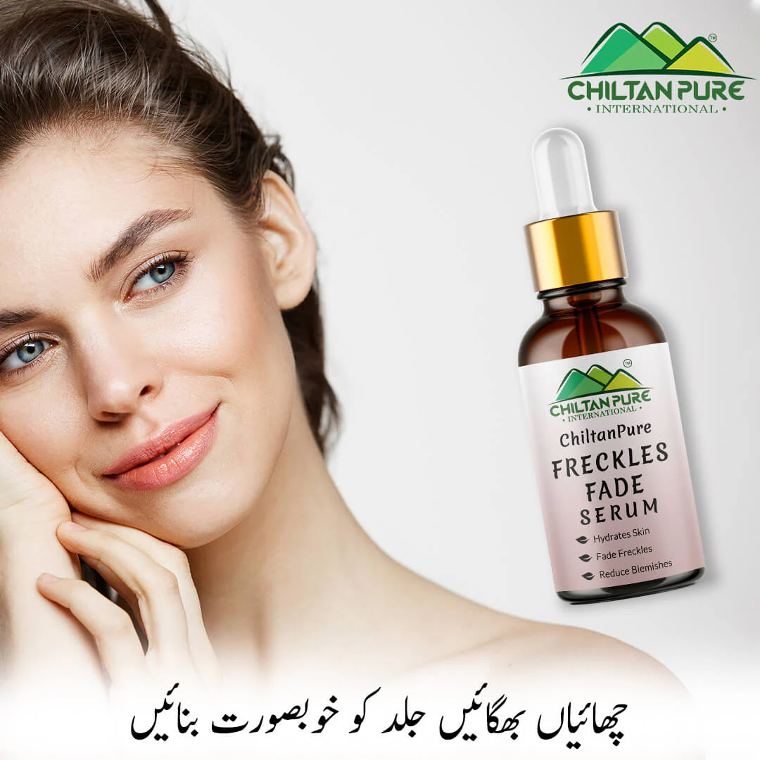 Freckles Fade Serum – Hydrates Skin, Fade Freckles, Reduce Blemishes & Lighten Pigmentation - Image 3