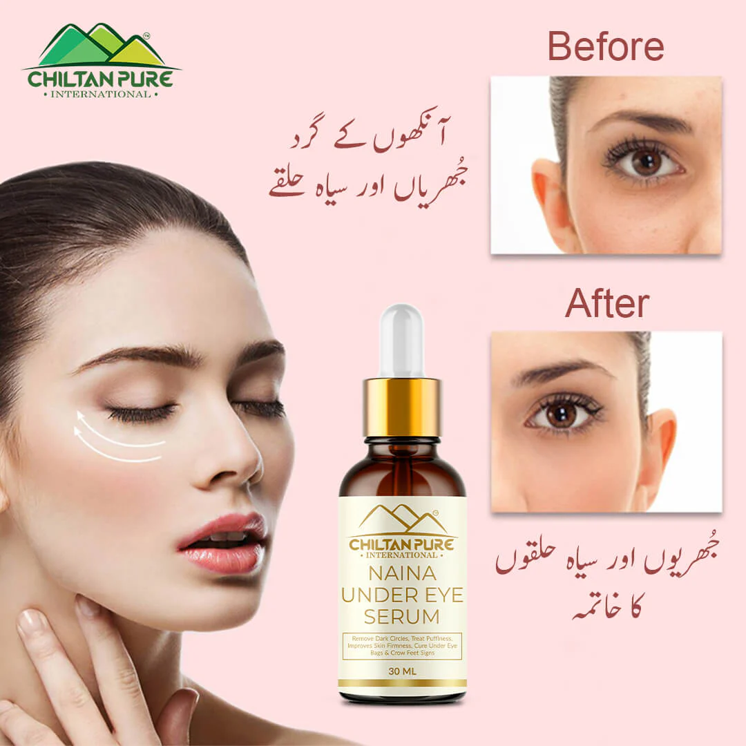 Naina Under Eye Serum – For Firm Delicate Skin, Support firm refreshed look – Reduce fine lines, Dark circles & Puffiness (100% result) - Image 3