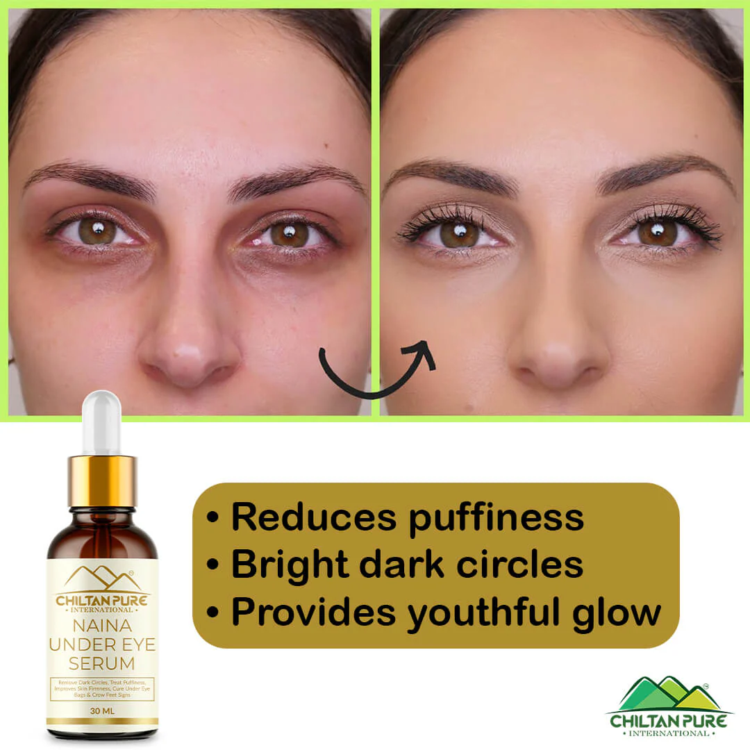 Naina Under Eye Serum – For Firm Delicate Skin, Support firm refreshed look – Reduce fine lines, Dark circles & Puffiness (100% result) - Image 4