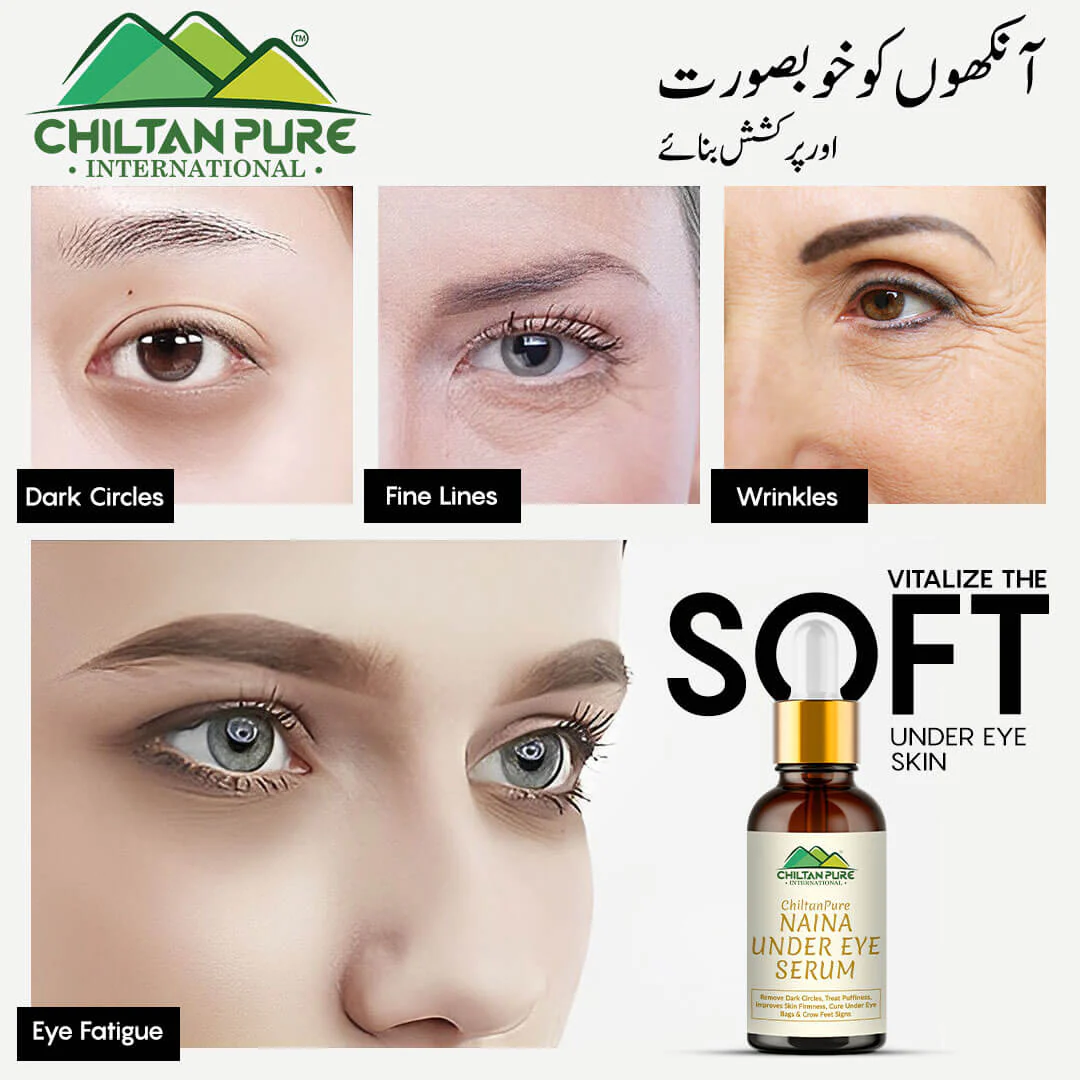 Naina Under Eye Serum – For Firm Delicate Skin, Support firm refreshed look – Reduce fine lines, Dark circles & Puffiness (100% result) - Image 5
