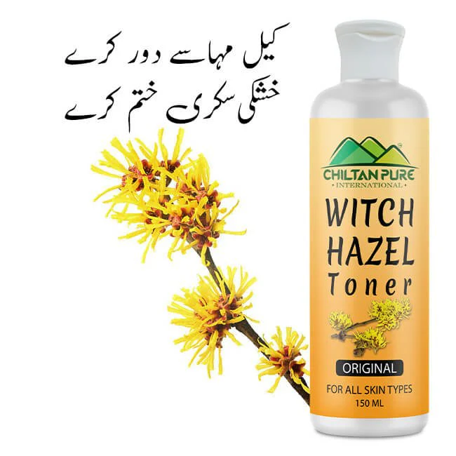 Witch Hazel Toner (Original) – Pore Perfecting Toner, Reduces Inflammation, Soothes Skin & Fights Acne